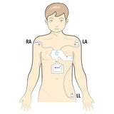 Electrode Strips Prepositioned Sm thru XL for QHeart™ ECG Machine by QT Medical